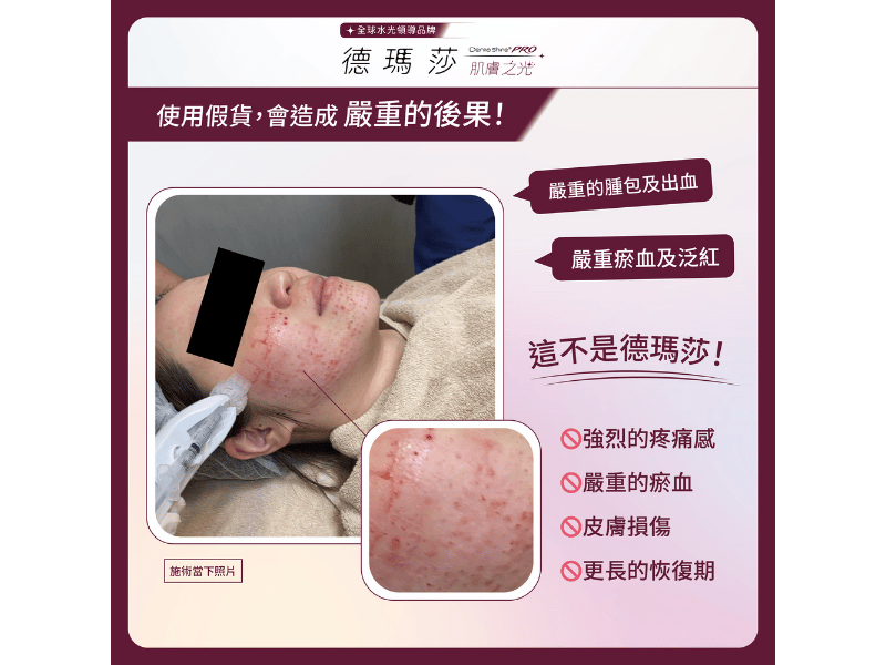 skinbooster11