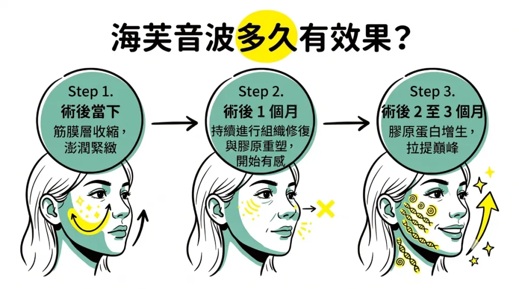 海芙音波多久有效？效果漸進式時間